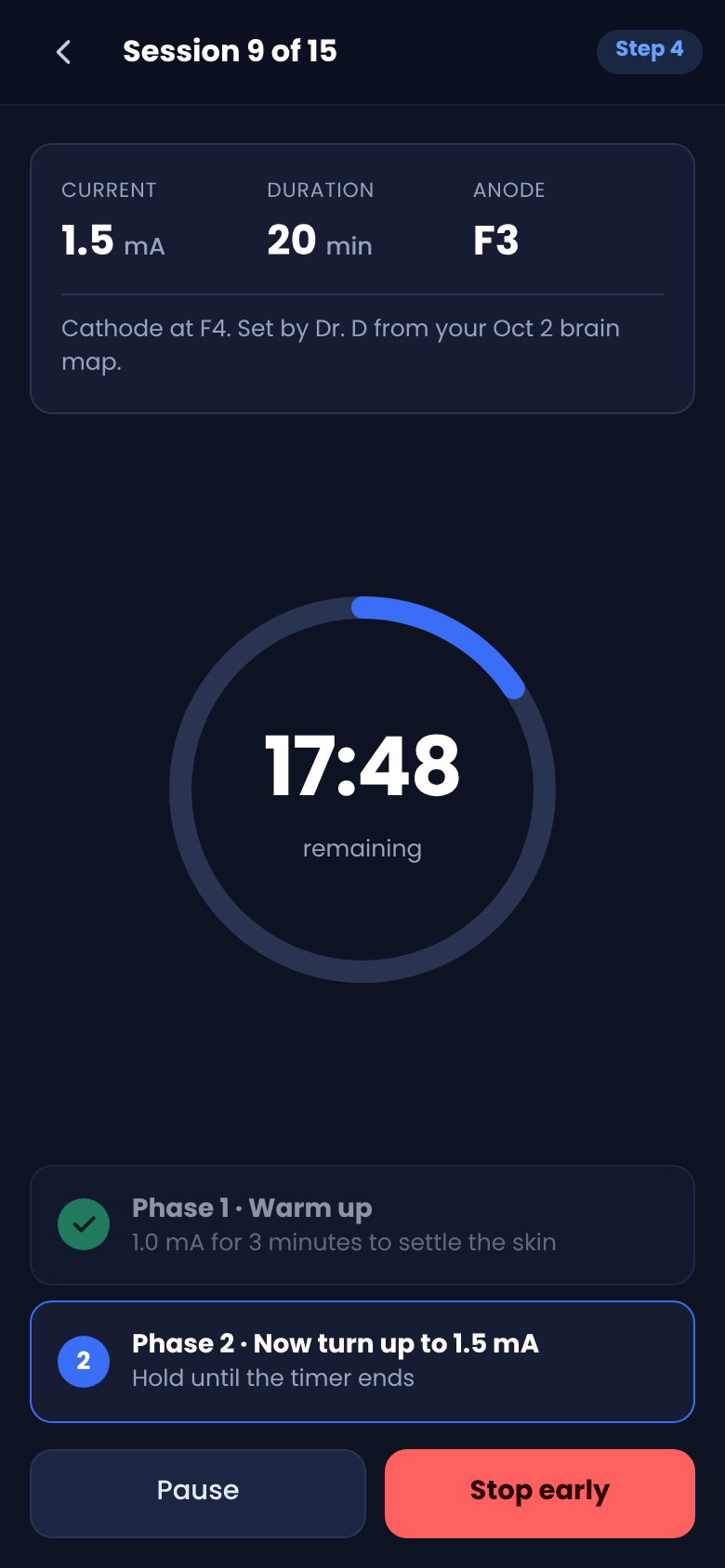 The session screen with a ring timer and two phases, warm up then full current